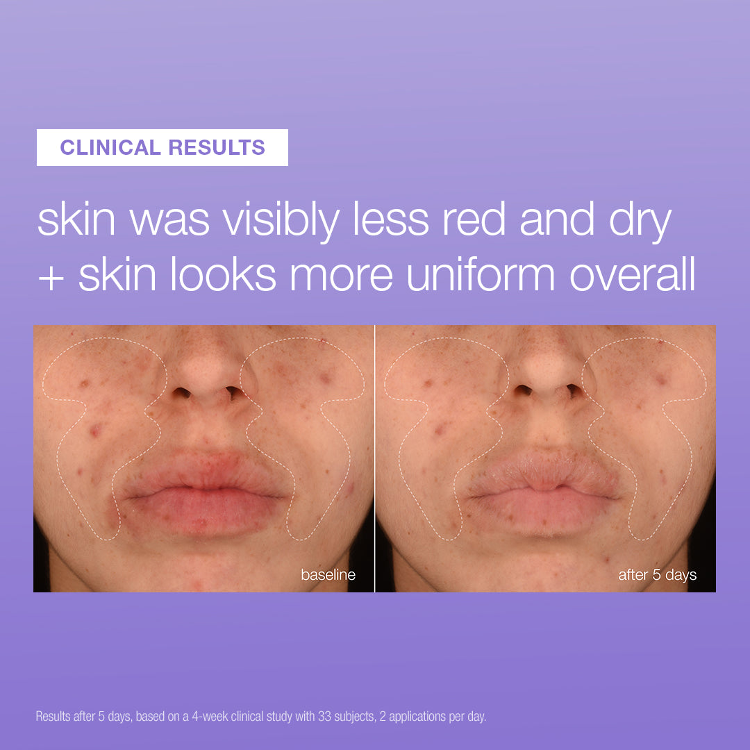 UltraCalming Stabilizing Repair Serum Entry Deal