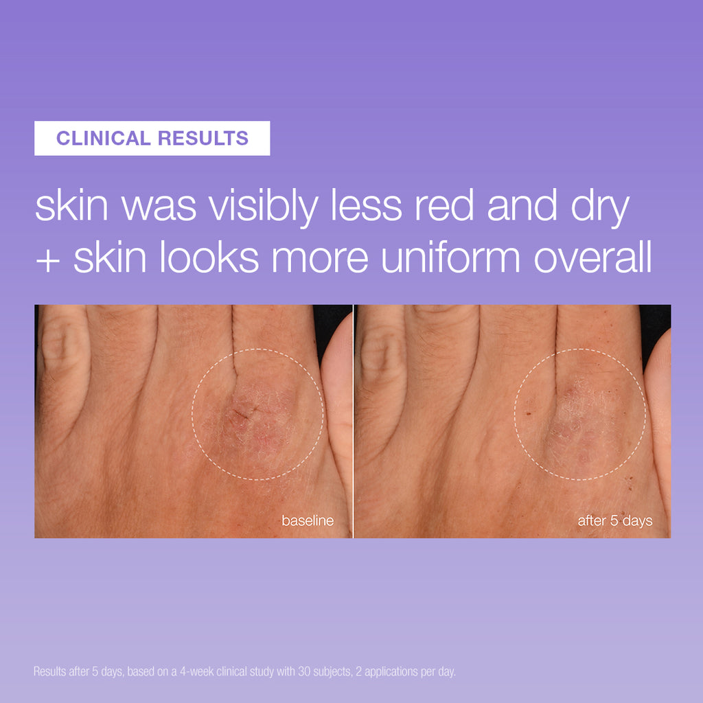 UltraCalming Stabilizing Repair Serum Entry Deal