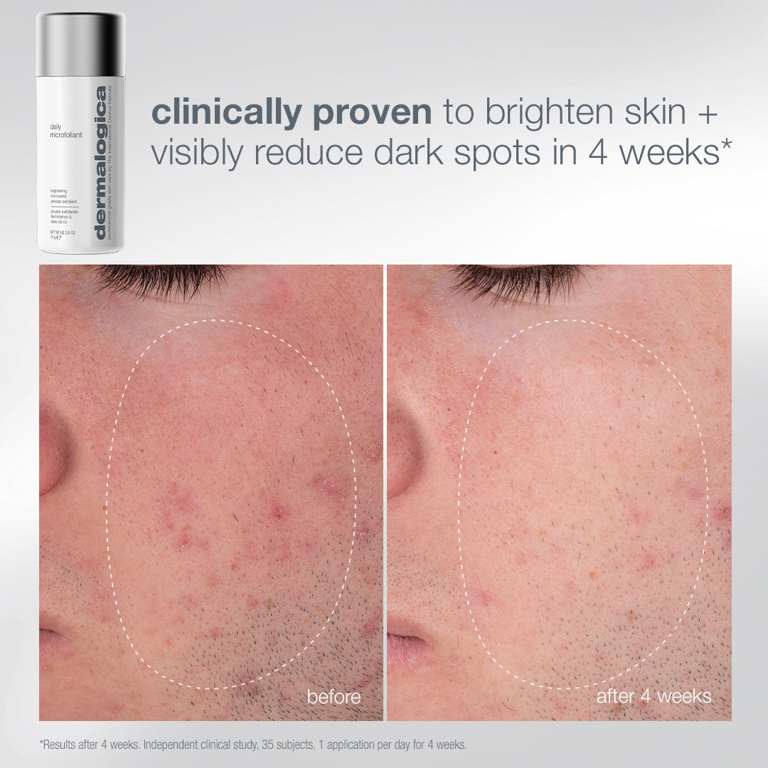 Pro Ritual: Exfoliate & Glow - YEP26
