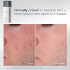 Expert Cleanse & Glow - YEP26
